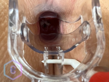 my first time using my speculum