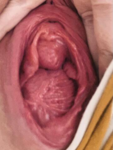 up my shorts gape 💛😊