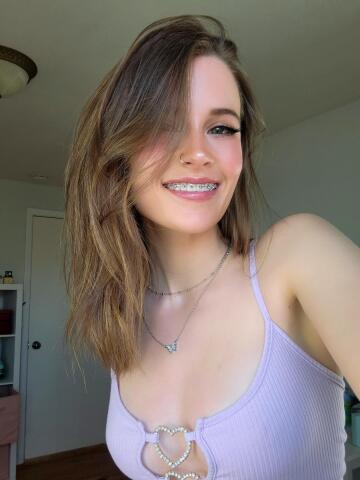 a big braceface smile😁