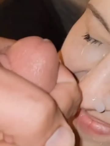 i can still see out of my other eye but you can fix that.