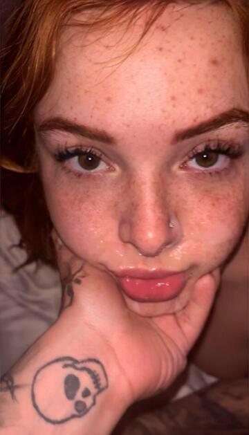 nut on a gingers freckles