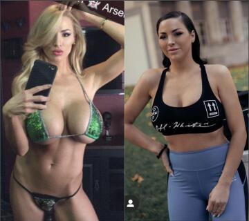 then and now. implants removed and face pumped full of botox. sad.