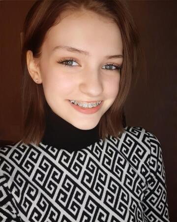 i wanna know if u would cum all over these braces ;3