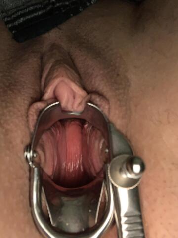 my uterus is too tilted to see my cervix but i still love the speculum (nb)