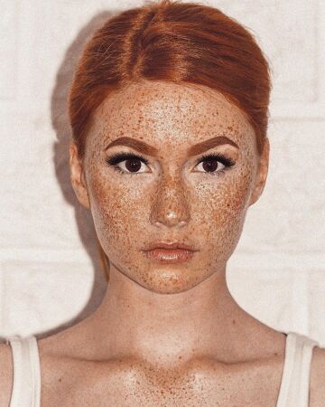 ginger freckles 💘