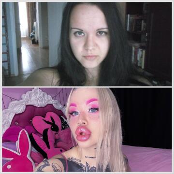 10 years difference 💖 bimbofication its best thing ever happened in my life💖