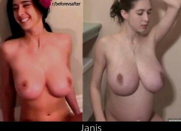 janis before and during pregnancy