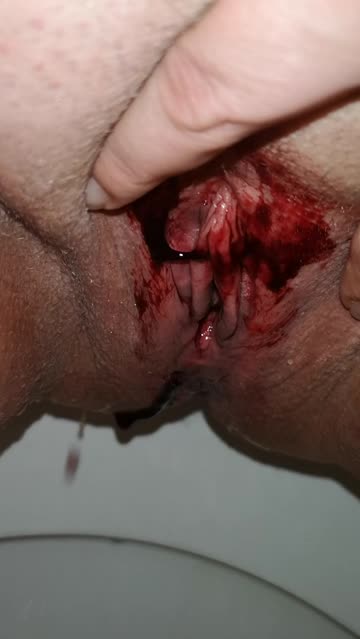 pissing with a clot covered pussy