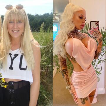from basic natural girl to plastic bimbo queen 💉💕 alicia amira