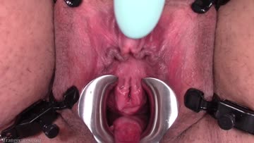 three-bladed anal speculum in my peehole