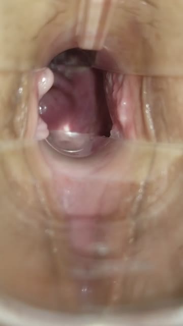 squeezing a speculum!