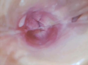 haven't posted here in a bit. i've been having fun with the endoscope someone was kind enough to send me from this place :] i'll post a few more of these here over the next few days. finally got myof setup too.