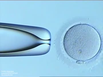 how a sperm is injected directly into the egg using a fine glass needle