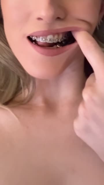 small tits braces amateur porn video