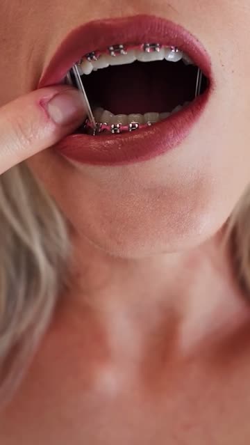 braces petite small tits porn video