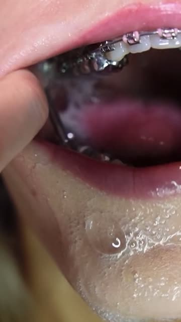 braces tongue fetish petite sex video