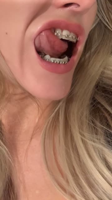 r/ddlg small tits daddy braces 