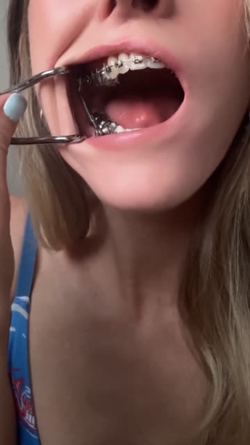 braces oral tongue fetish 